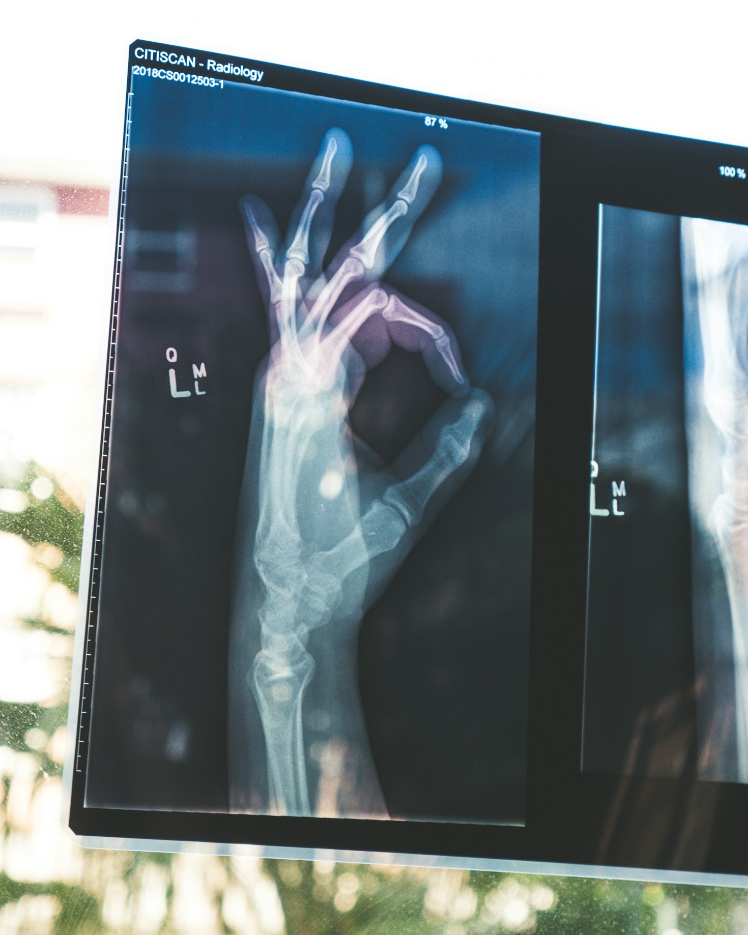 The Benefits of Agency Nursing: Flexibility and Freedom